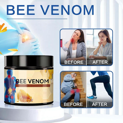 Cream with bee venom to relieve joint and bone pain